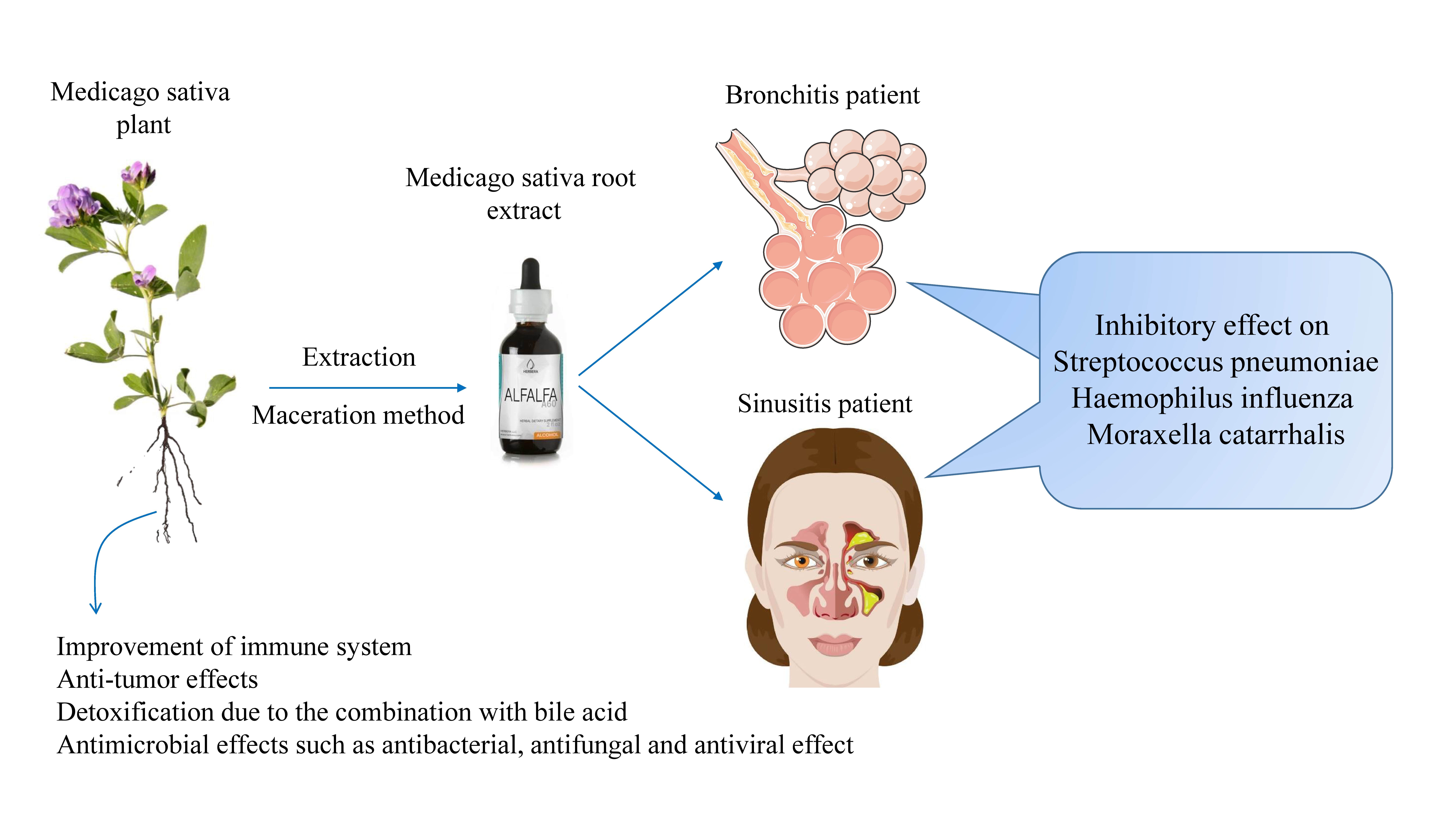 Antibacterial effect of Medicago sativa extract on the common bacterial in sinusitis infection 